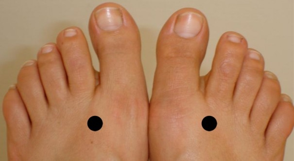 Acupuncture Weight Loss Acupuncture Points Chart Thepiratebayinside