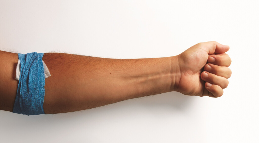 Can You Exercise After Giving Blood 