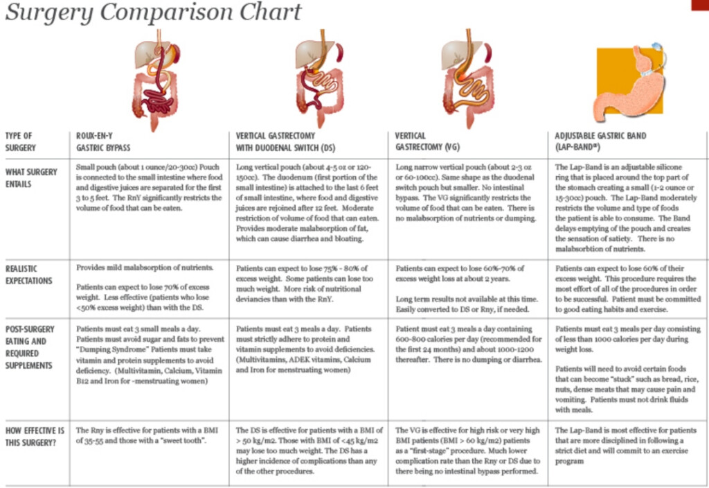 DIET FAILURE Can Weight Loss Surgery Help 