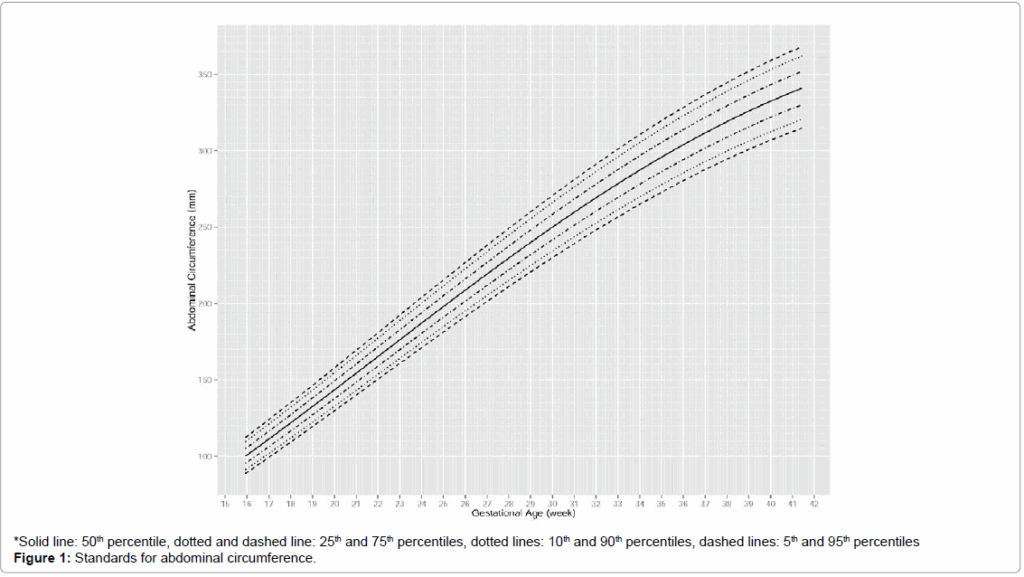 Fetal Weight Percentile Chart