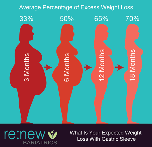 Gastric Sleeve Average Weight Loss Timeline Chart Artofit