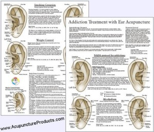 Smoking Cessation Weight Loss Ear Acupuncture Points Chart EBay